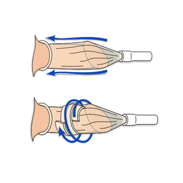 Urocare Uro-Con - 4" Texas Catheter with Urofoam Strip Product Information View