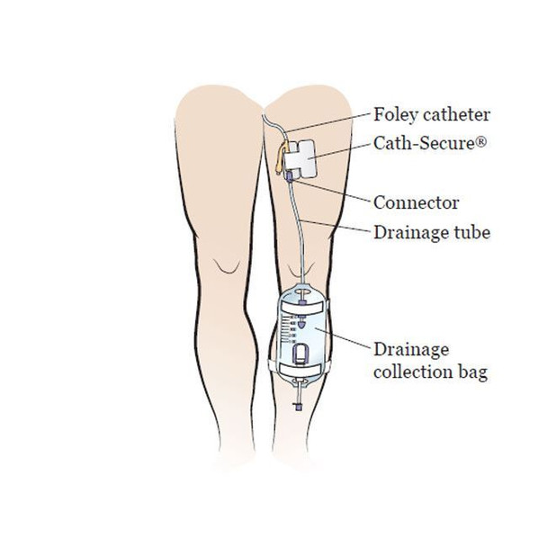 Cath Secure Lock - Multi-Purpose Tube Holder Product Information View