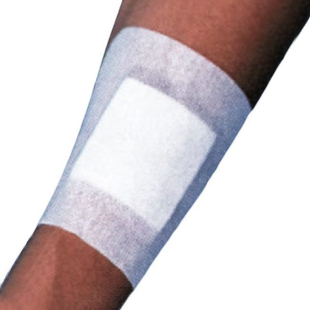 MPM Medical WoundGard - Sterile Bordered Gauze Dressing In Use View