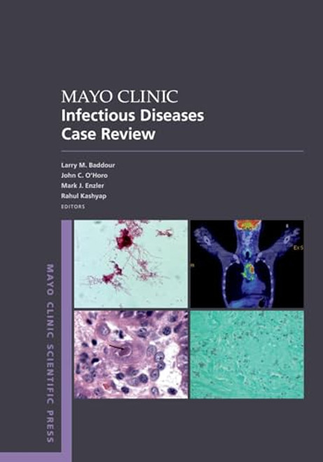 Mayo Clinic Infectious Disease Case Review: With Board-Style Questions and Answers (Mayo Clinic Scientific Press)