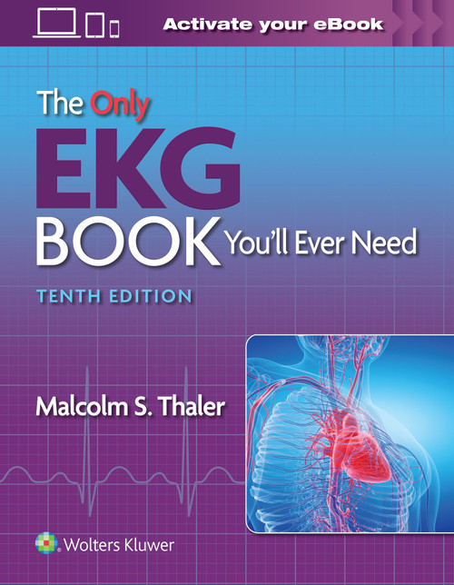 The Only EKG Book Youll Ever Need