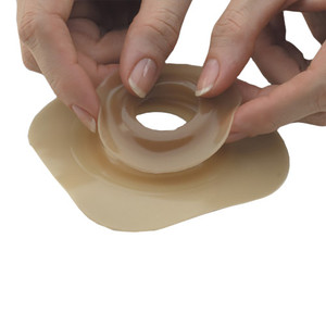 OSTOMY SEAL RING CONVEX 1 9/16IN ADAPT (10/BX 56BX/CS) [HOL79540]
