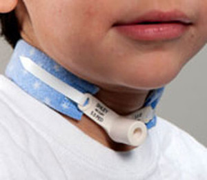 TRACHEOSTOMY TUBE TIES HOLDERS SOFT FOAM COLLAR VELCRO LF 2-PC 1IN FITS UP TO 18IN PEDIATRIC DALE MEDICAL (10/BX) [DAL241-EA]