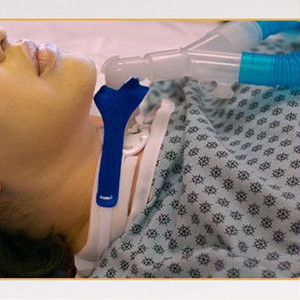 TRACHEOSTOMY TUBE TIES HOLDERS SOFT FOAM COLLAR CIRCUIT VENT ANTI-DISCONNECT LF PEDIATRIC MARPAC (10/BX) [779-905D]