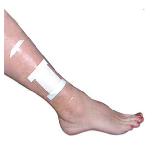 DRESSINGS WOUND PROTECTOR SHIELD DISP LF SHOWER PATCH 5IN X 8IN SEAL-TIGHT (5/PK) [047-20435]