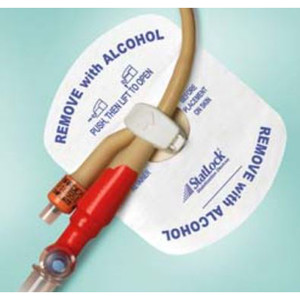 STABILIZATION DEVICE PEDIATRIC STATLOCK W/FOAM ANCHOR PAD (25/CS) [BUVFDSSP]