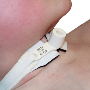 TRACHEOSTOMY TUBE TIES HOLDERS SOFT FOAM COLLAR VELCRO LF 2-PC 1IN FITS 6-12IN NEONATAL/PEDIATRIC W/CUSHION MARPAC (10/BX) [779-235D-EA]