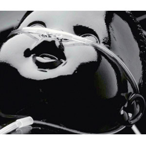 CANNULAS OXYGEN NASAL CURVED TIP PEDIATRIC CLEAR CRIMP RESIST W/ 7FT TUBING SUNMED (50/CS) [157-1602-7-50]