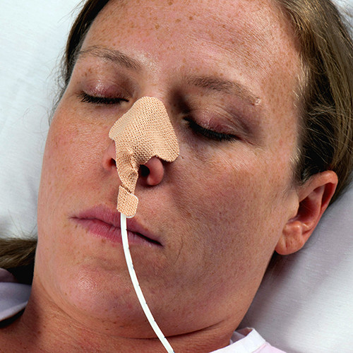 HOLDERS TUBE NASOGASTRIC ADHESIVE ONE-SIZE FITS MOST (50/BX) [DAL160]