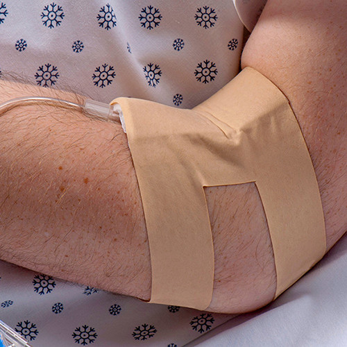 IV SITE PROTECTION OVERLAY ADHESIVE LF ONE-SIZE FITS MOST IV ARMOR (10/BX) [DAL675]