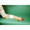BANDAGES STRETCH NET TUBULAR DRESSING RETAINER COTTON LF SIZE 05 LG ARM LEG HAND FT THIGH .875IN X 25YD (EA) [500-TEB05]