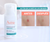 AVENE CLEANANCE COMEDOMED