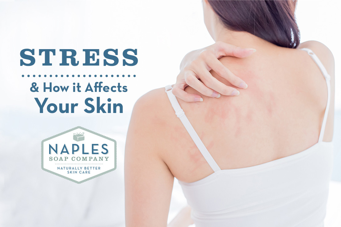 How Stress Affects the Skin How Stress Affects the Skin
