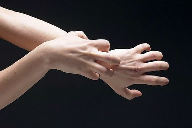 Is Eczema Contagious? Answering Frequently Asked Questions About This