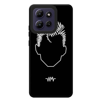 Alex Turner Arctic Monkeys Motorola Moto G Play 2026 Case