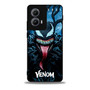 Venom Tom Hardy Motorola Moto Edge Case