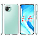 Xiaomi Mi 11 Lite 5G Soft Gel Case