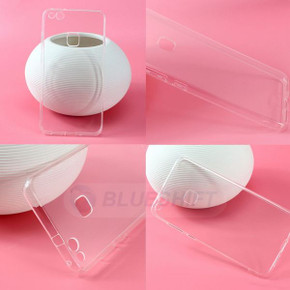 Huawei   Huawei P10 Lite      Soft Gel Case