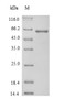 (Tris-Glycine gel) Discontinuous SDS-PAGE (reduced) with 5% enrichment gel and 15% separation gel.