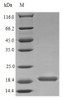 Recombinant Human Interleukin-17B protein (IL17B) (Active) | CSB-AP001651HU