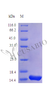 Recombinant Human Interleukin-2 protein (IL2) (Active) | CSB-AP001691HU