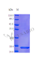 Recombinant Human Interleukin-36 gamma protein (IL36G) (Active) | CSB-AP002041HU