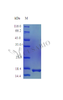 Recombinant Mouse Interleukin-1 beta protein (Il1b) (Active) | CSB-AP003261MO