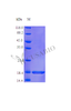 Recombinant Human Granulocyte colony-stimulating factor protein (CSF3) (Active) | CSB-AP002071HU