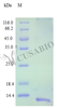 Recombinant Human C-X-C motif chemokine 13 protein (CXCL13) (Active) | CSB-AP000771HU