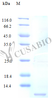 Recombinant Human Fractalkine protein (CX3CL1) (Active) | CSB-AP000801HU