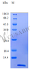 Recombinant Human C-C motif chemokine 2 protein (CCL2) (Active) | CSB-AP000821HU