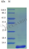 Recombinant Human C-C motif chemokine 27 protein (CCL27) (Active) | CSB-AP001001HU