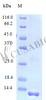 Recombinant Human Protein FAM19A2 protein (FAM19A2) (Active) | CSB-AP001021HU Recombinant Human Protein FAM19A2 protein (FAM19A2) (Active) | CSB-AP001021HU