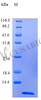 Recombinant Rhesus Macaque Eotaxin protein (CCL11) (Active) | CSB-AP001041MOW