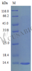 Recombinant Mouse C-C motif chemokine 28 protein (Ccl28) (Active) | CSB-AP001081MO