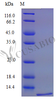 Recombinant Mouse C-X-C motif chemokine 16 protein (Cxcl16) (Active) | CSB-AP001191MO
