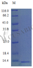 Recombinant Mouse C-C motif chemokine 9 protein (Ccl9) (Active) | CSB-AP001281MO
