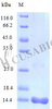 Recombinant Mouse C-C motif chemokine 25 protein (Ccl25) (Active) | CSB-AP001371MO
