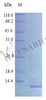 Recombinant Rat C-X-C motif chemokine 10 protein (Cxcl10) (Active) | CSB-AP001451RA
