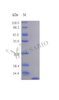 Recombinant Rat C-C motif chemokine protein (Ccl22) (Active) | CSB-AP001581RA
