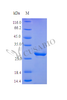 Recombinant Human Insulin-like growth factor-binding protein 5 protein (IGFBP5) (Active) | CSB-AP002501HU
