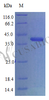 Recombinant Human CCN family member 1 (CCN1) (Active) | CSB-AP002661HU
