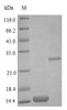 Recombinant Human Bone morphogenetic protein 2 protein (BMP2) (Active) | CSB-AP002981HU
