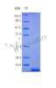 Recombinant Human Tumor necrosis factor receptor superfamily member 17 protein (TNFRSF17), partial (Active) | CSB-AP002271HU
