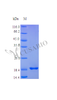 Recombinant Human Tumor necrosis factor ligand superfamily member 15 protein (TNFSF15) (Active) | CSB-AP002341HU
