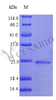 Recombinant Human Interferon alpha-1/13 protein (IFNA1) (Active) | CSB-AP002751HU
