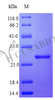 Recombinant Human Interferon alpha-2 protein (IFNA2) (Active) | CSB-AP002761HU
