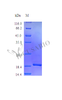 Recombinant Human Tumor necrosis factor receptor superfamily member 11B protein (TNFRSF11B) (Active) | CSB-AP003001HU
