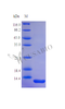 Recombinant Human Parathyroid hormone protein (PTH) (Active) | CSB-AP000051HU
