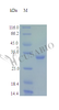 Recombinant Human Fructose-2, 6-bisphosphatase TIGAR protein (TIGAR) (Active) | CSB-AP000111HU
